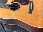 Close up of Soundhole and side knobs