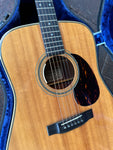 Closeup of body and sound hole for 1974 Alvarez Yairi DY 57   With L.R. Baggs Anthem True Mic